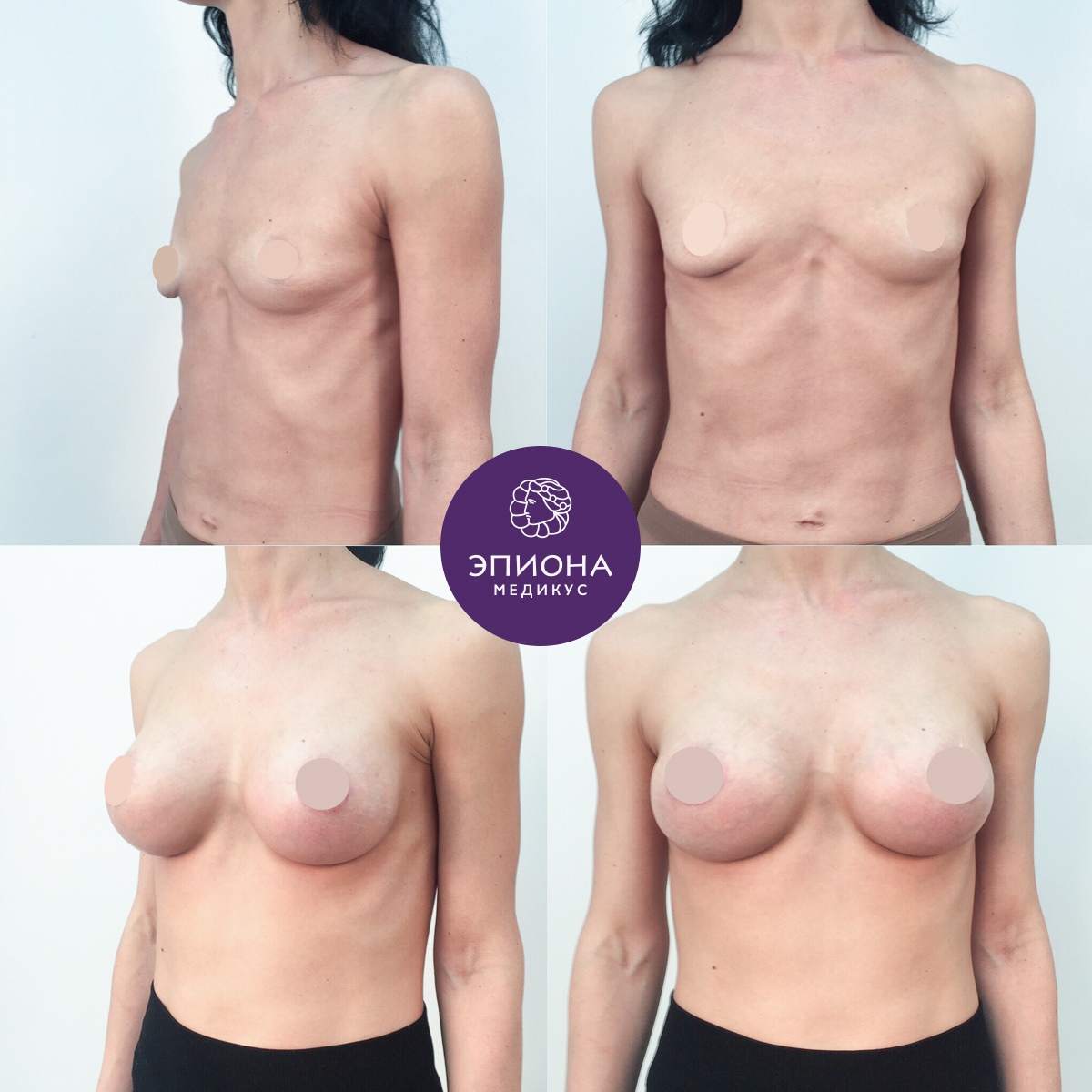 изменение груди с возрастом у женщин фото 20